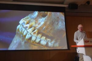 Don Walker showing a slide of a dentition with localized wear
